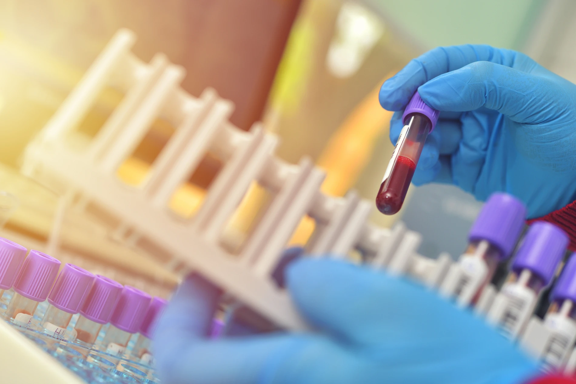 Dr. Stacy Month - Hematology